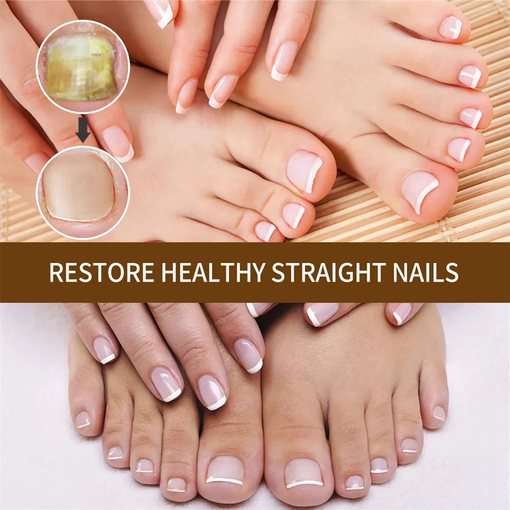 2pcs Nail Growth DeepHealing Organic Sizeerum 30ml