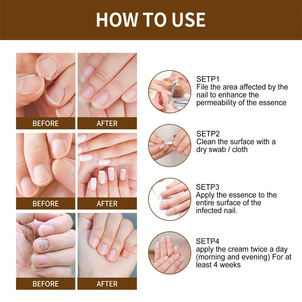 2pcs Nail Growth DeepHealing Organic Sizeerum 30ml